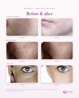 Before and after skin comparison across texture, tone and fine lines