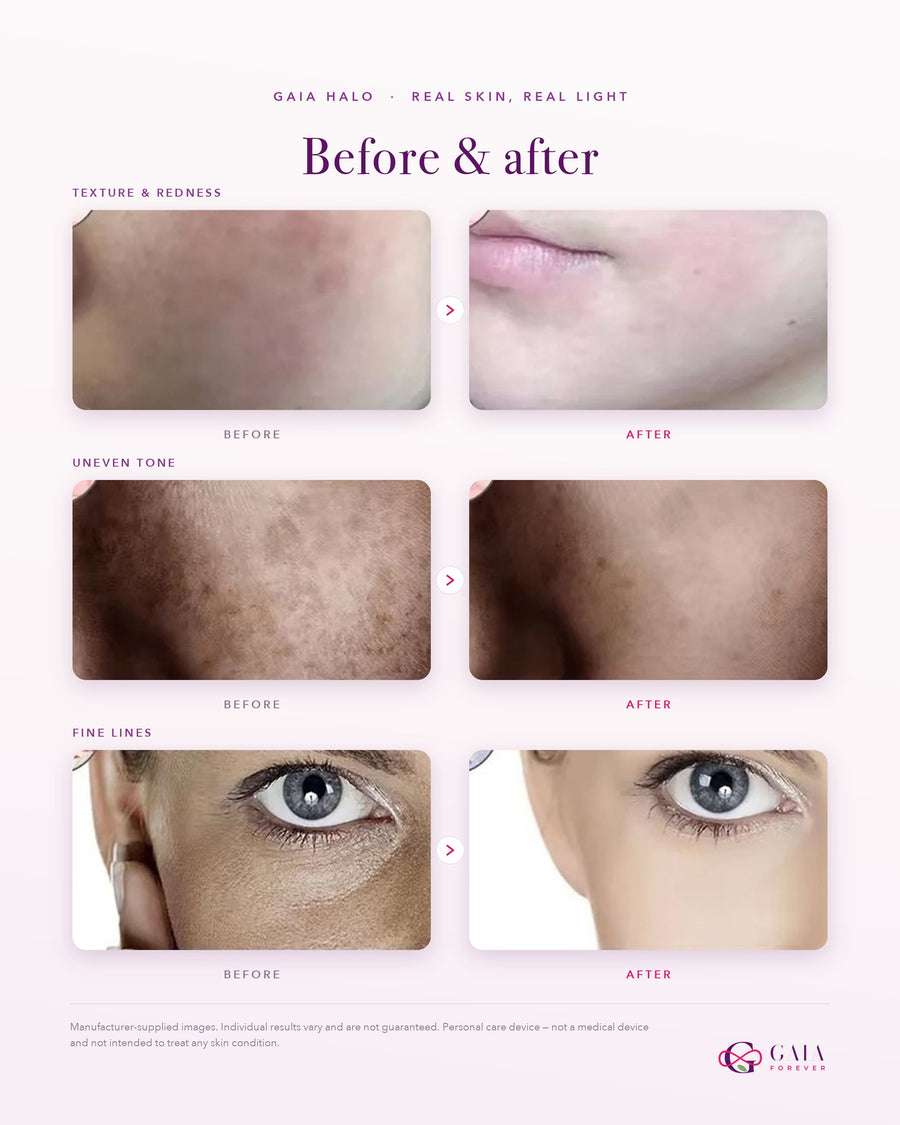 Before and after skin comparison across texture, tone and fine lines